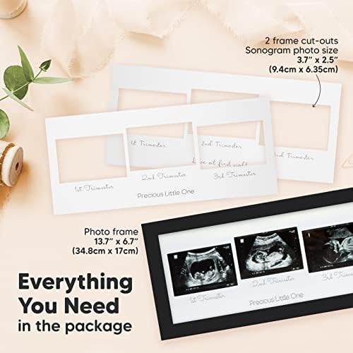 Рамка за сонограммы - Три Ултразвукови рамки за снимки за подарък на бъдещата майка - Рамка за ЕХОГРАФИЯ на детето - Обяви