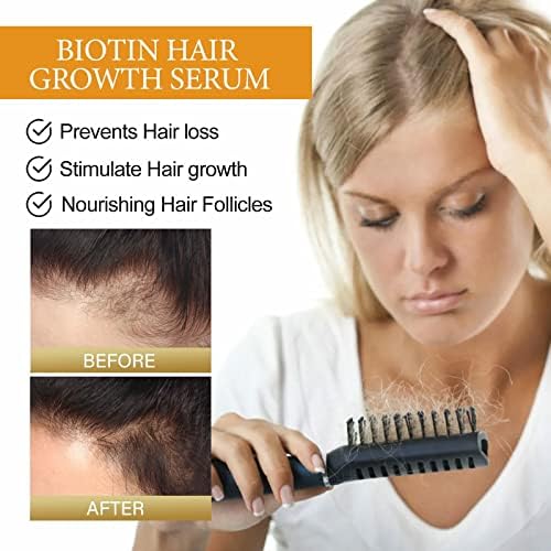 Гъста Хидратиращ Балсам за Гъста коса, което предотвратява Загубата на Определен Климатик за възстановяване на корените на косата